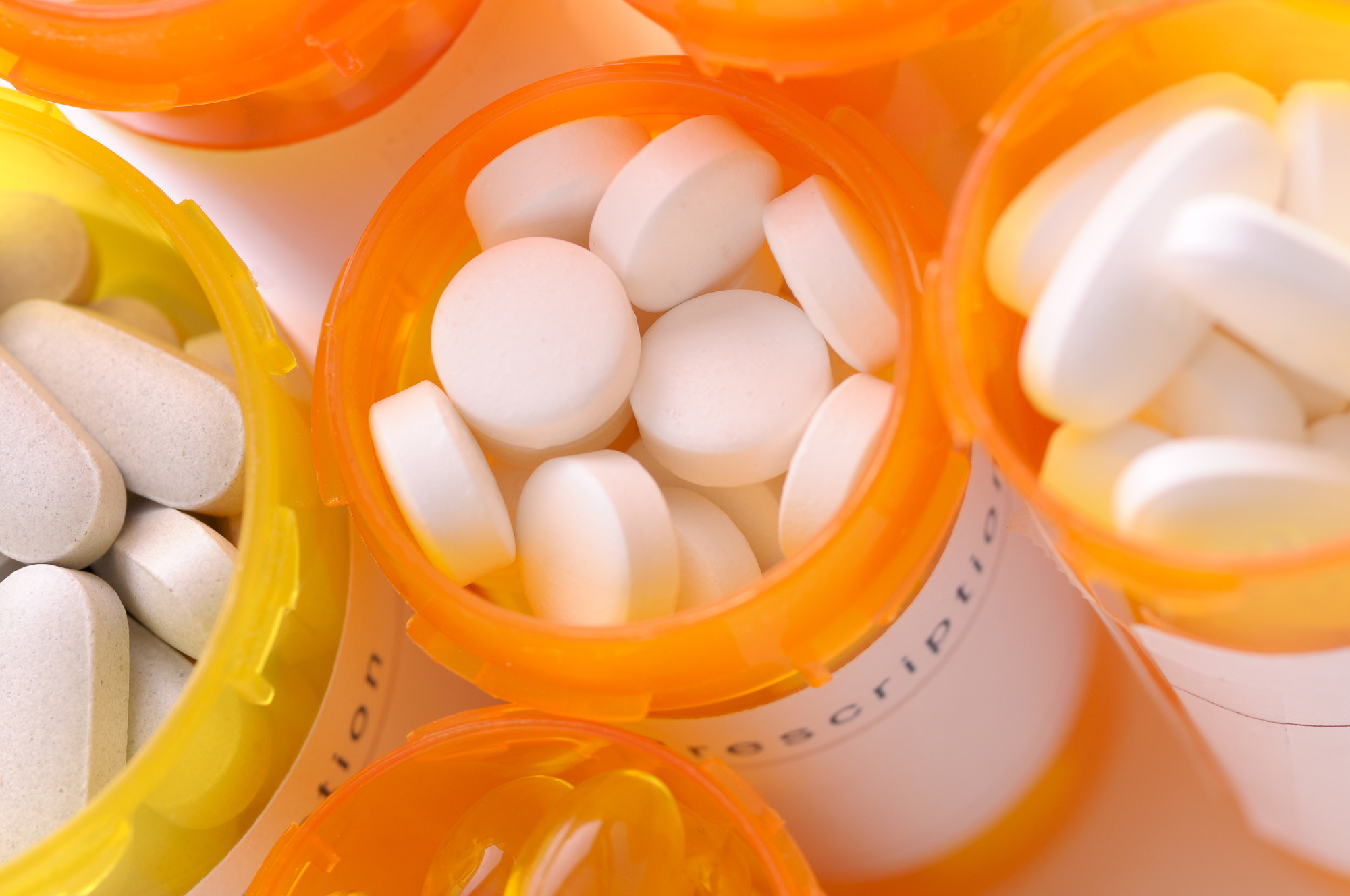 do you need a prescription
