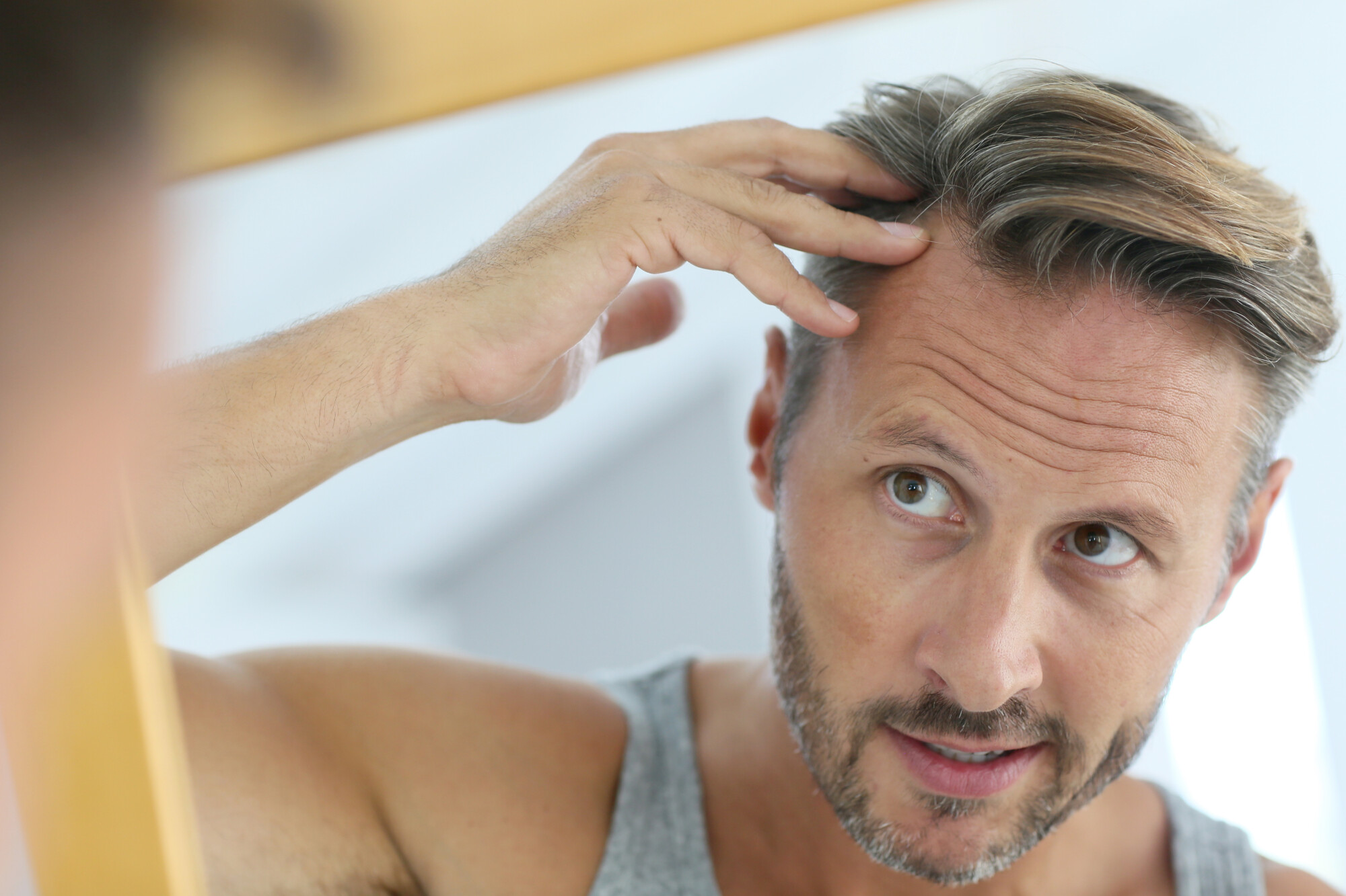 Propecia vs Rogaine for Men: Which Is Better for Fighting Hair Loss?