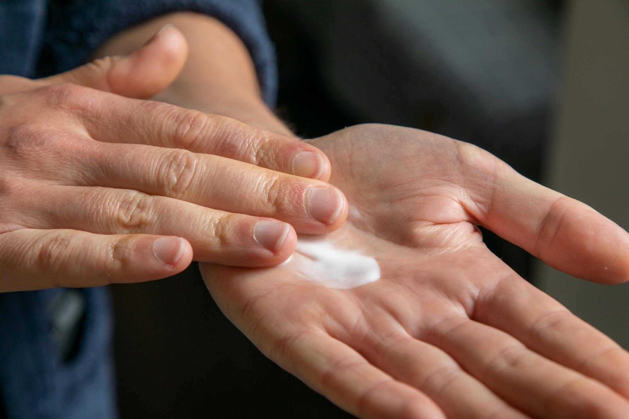 Why Is Tacrolimus Ointment So Expensive?